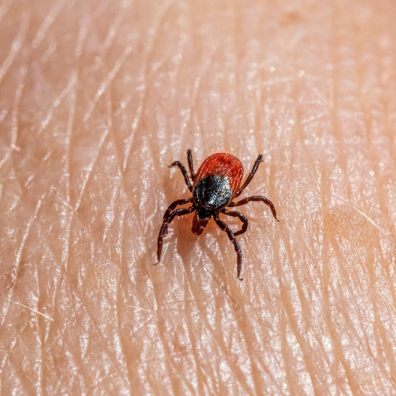A tick on someone's hand